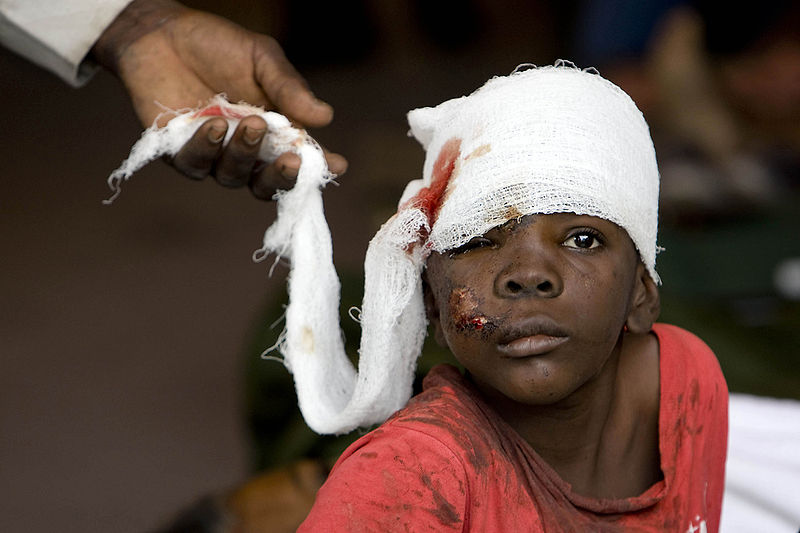 Boy receiving treatment after Haiti earthquake Logan Abassi / The United Nations